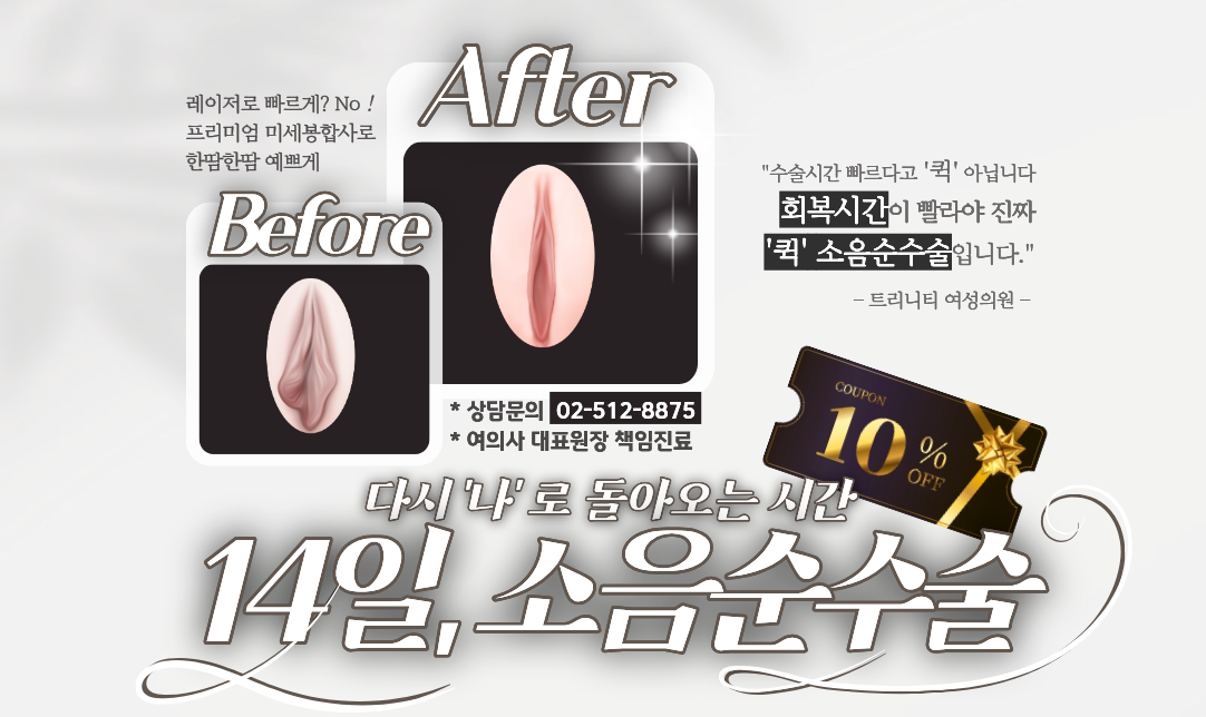 리턴14소음순 이벤트